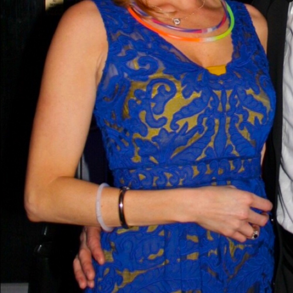 ✨Stunning Lace Yoanna Baraschi V-Neck Dress✨